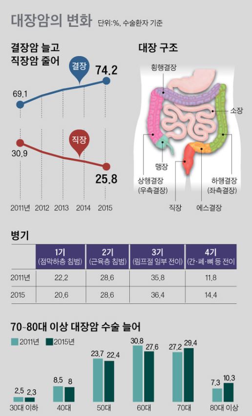 캡처 대장암1.JPG