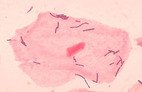 Lactobacillus GG